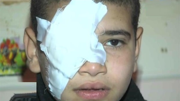 بالفيديو… طالب يفقد «عينه» داخل مدرسة بطنطا