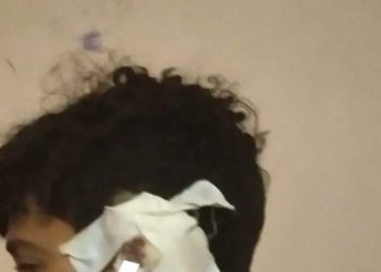 طالب يقطع أذن صديقه بآلة حادة لرفضه مشاركته لعب الكرة بالزقازيق