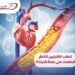 تصلب الشرايين الخطر الصامت على صحة قلبك!!