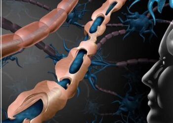 مرض التصلب المتعدد MS