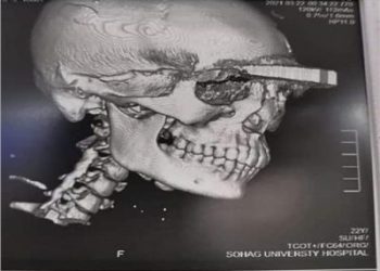 إعترافات مثيرة لربة منزل قطعت أصابع ضرتها وهشمت رأسها بالساطور